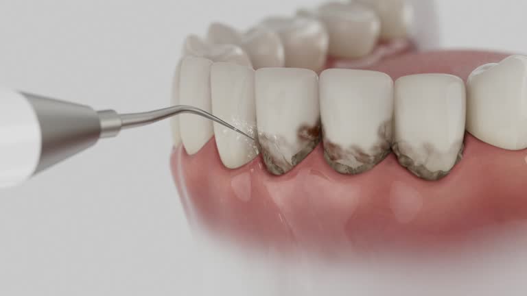 Trusted Wisdom Tooth Removal service in Dillingham, AK - Dentist Open Now
